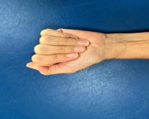 Hand with fingers folded down over the palm